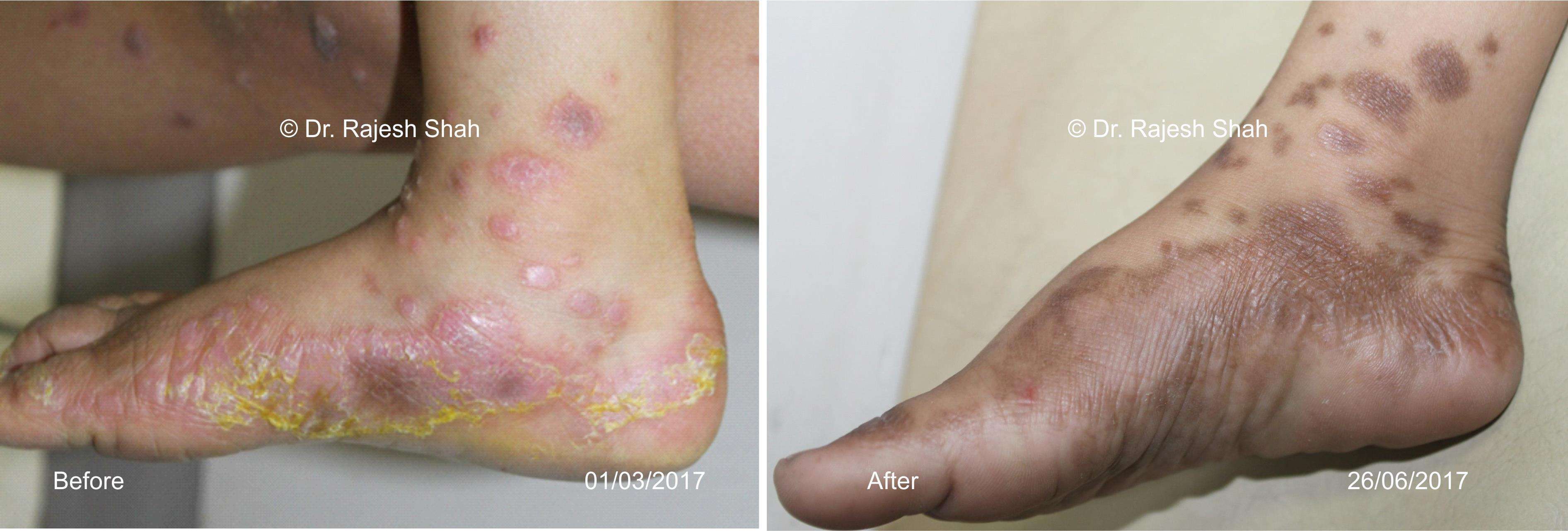 lifeforce homeopathy case-photos